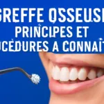 Qu’est-ce qu’une greffe osseuse et pourquoi en avez-vous besoin ?