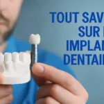 Qu&rsquo;est-ce qu&rsquo;un implant dentaire et comment fonctionne-t-il ?