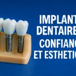 Pourquoi opter pour des implants dentaires ?