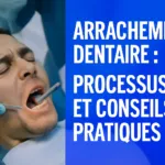 Comprendre l&rsquo;arrachement dentaire et son déroulement