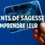 Que savoir sur les dents de sagesse ?
